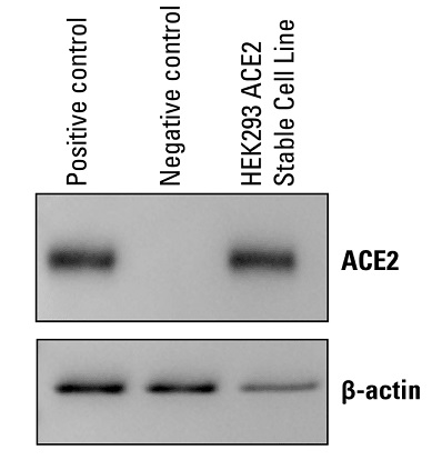 ACE2 Expression